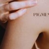Kūno pigmentinės dėmės