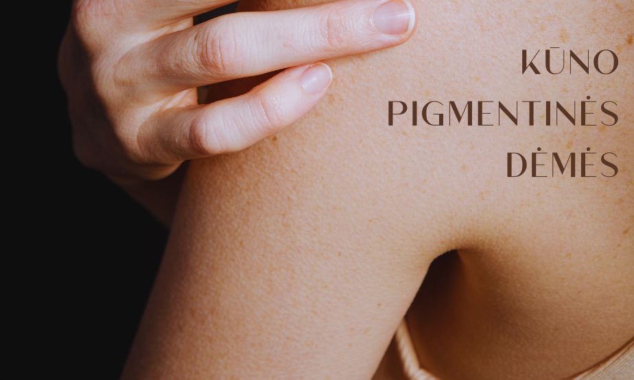 Kūno pigmentinės dėmės